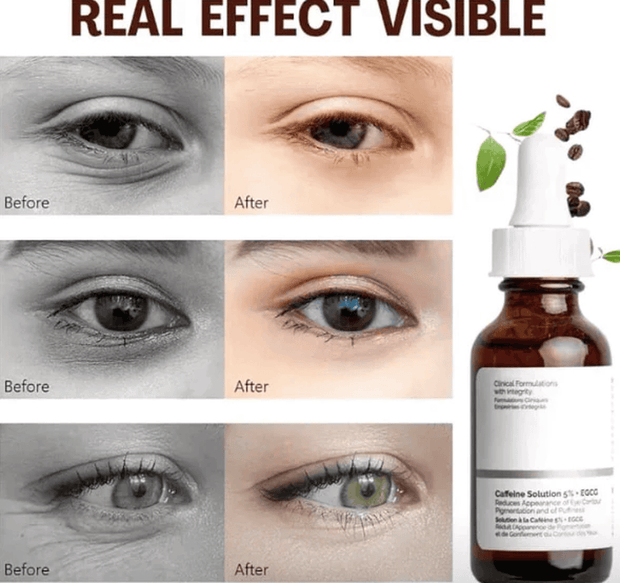 ROLANYIN Caffeine Solution 5% + EGCG Eye Serum for Puffiness Reduction Dark Circle Treatment Hydrating Firming and Soothing Anti Aging Nourishing Formula Eye Skin Care 1 Fl.Oz